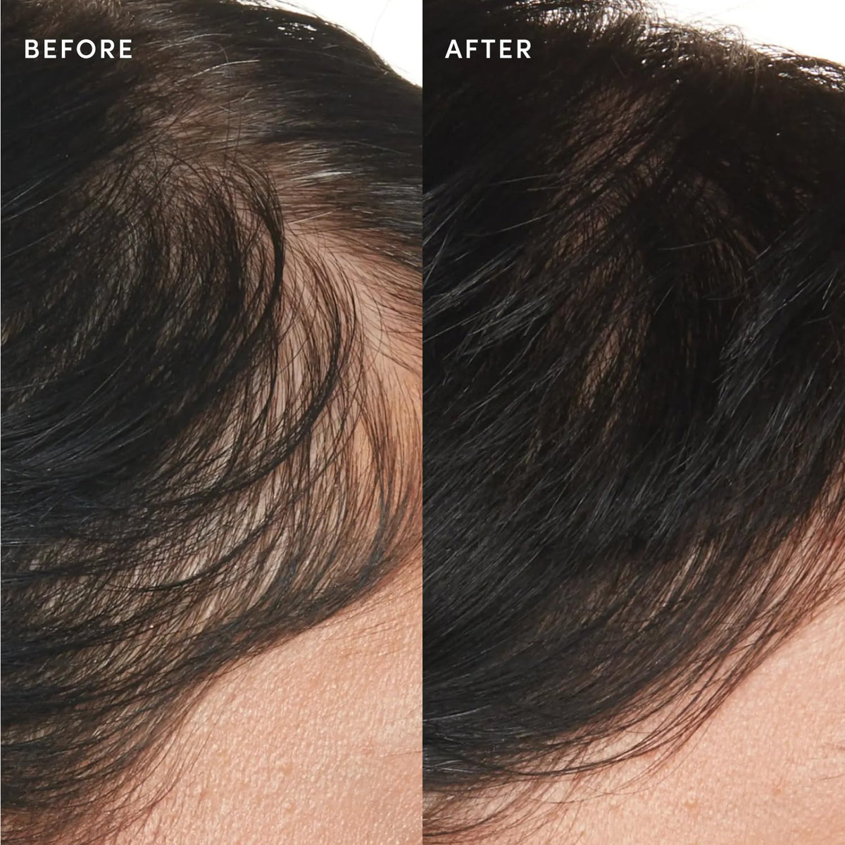 OUAI Scalp Serum for Thicker, Fuller-Looking Hair – 2 oz / 60 ml